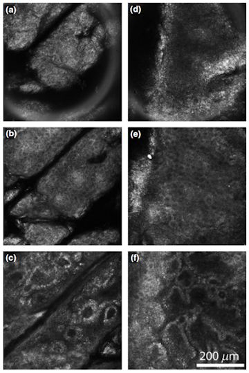 Confocal imaging of different regions of skin