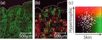 Image showing false colour scar tissue image as calculated using the discriminant analysis algorithm